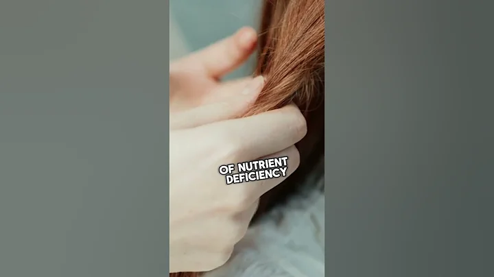 The 10 Hidden Signs Of Nutrient Deficiency You Should Never Ignore