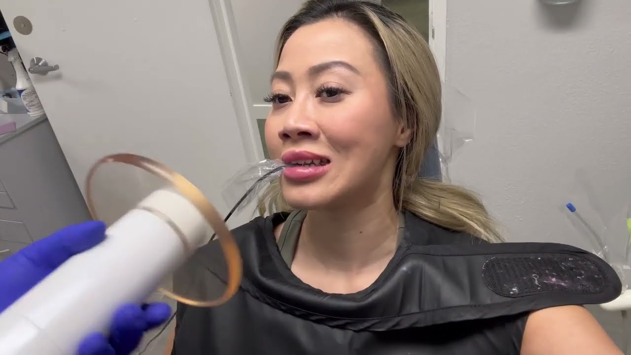 Teeth Cleaning & Cavity Filling at Happy Smiles Dental | Las Vegas Dentist Vlog