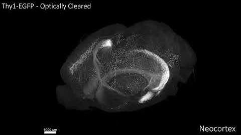 2020 FIRST PLACE VIDEO WINNER: Intact Whole-brain Imaging of Neurons