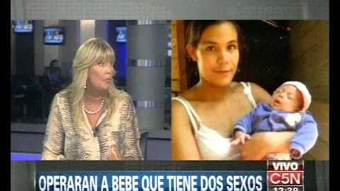 ¿Puede nacer un bebé con dos sexos?