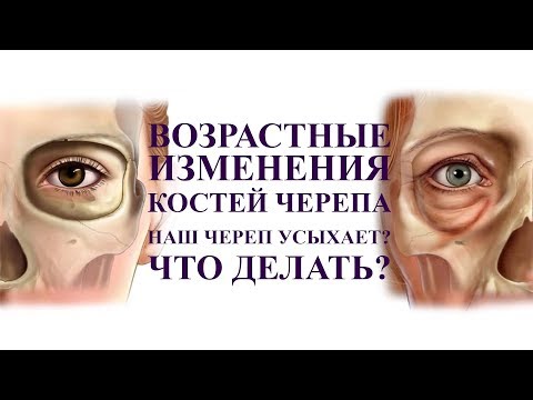 Кости черепа усыхают с возрастом?  А вы знали об этом? шок, что с этим делать?