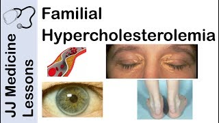 Familial Hypercholesterolemia | Genetics, Pathophysiology, Symptoms and Treatment