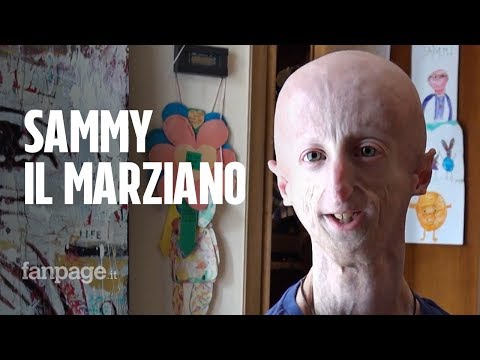 Sammy Basso, una