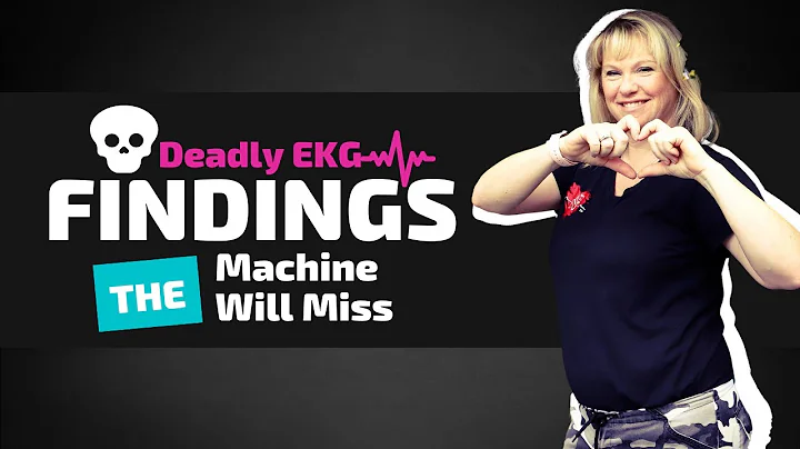 De Winters T Waves -- Why Should You Know This?