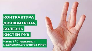 Болезнь кисти руки. Контрактура Дюпюитрена. Часть 1 / Специалист медицинского центра Мирт