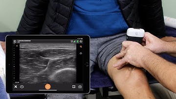 Ultrasound of the Knee