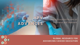Managing Oral Side Effects of Head and Neck Cancer Treatment - HPV Advances
