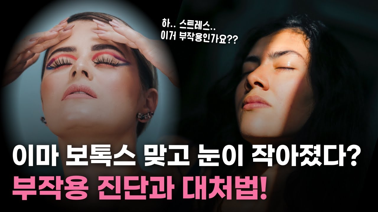 이마 보톡스 맞고 눈이 작아졌다? 저 어떡하죠..😱 (ft. 보톡스 부작용 해결법)