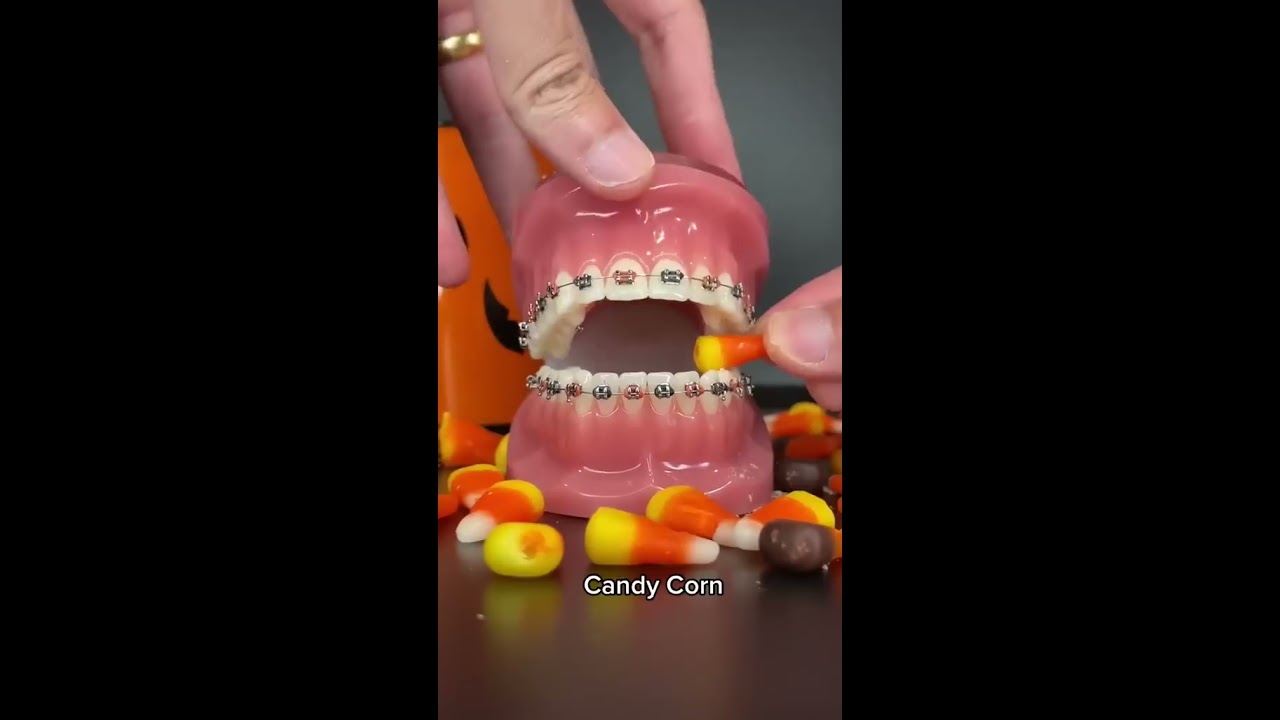Halloween Candies You Can Eat With Braces