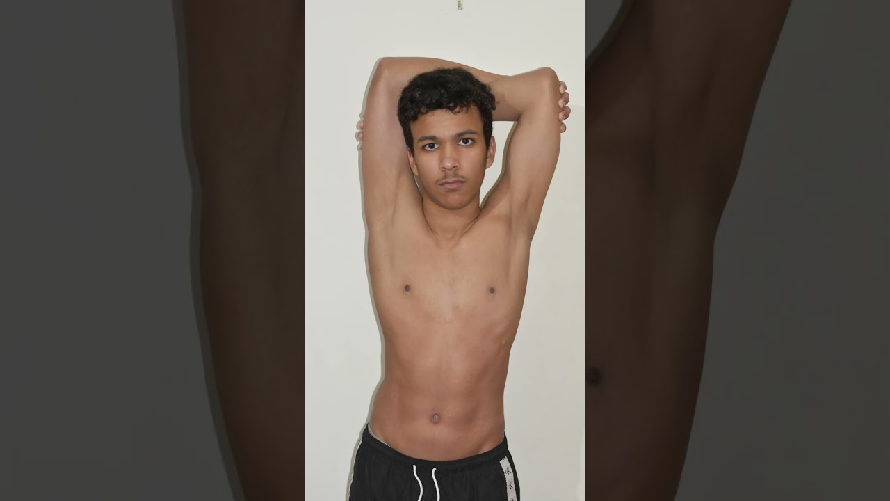 My 1 Year Gym Transformation with Scoliosis 📈