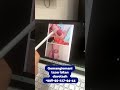 Gemangioma lazer bilan davolash