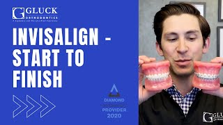 Invisalign Journey: Start to Finish from a Board Certified Orthodontist