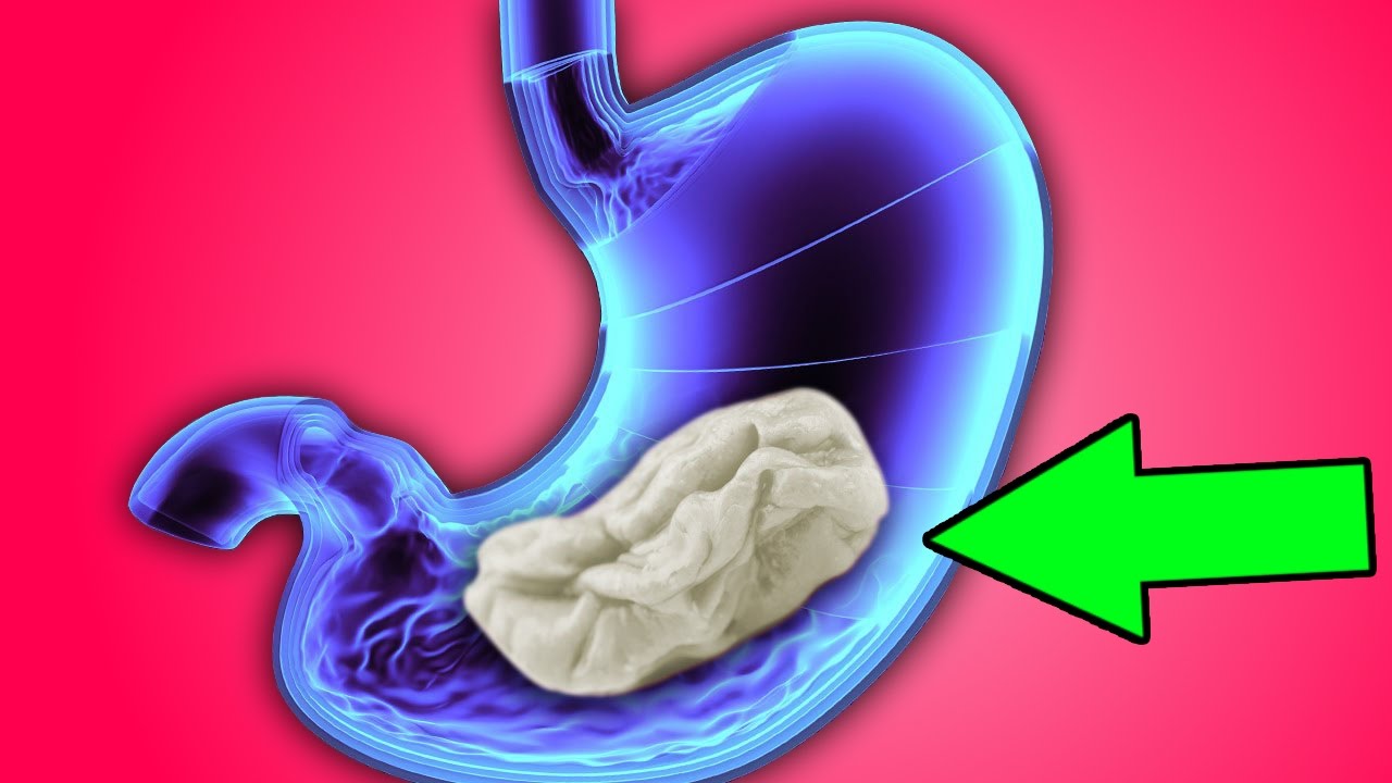 Что Будет на Самом Деле, Если Проглотить Жвачку