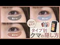 【クマの隠し方】あなたはどれに当てはまる？クマの原因と隠し方！（スキンケア/コンシーラー）