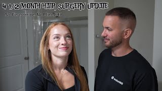 4 1/2 Months Hair Surgery Update!! No Finasteride, No Minoxidil!