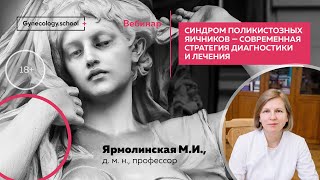 Синдром поликистозных яичников - современная стратегия диагностики и лечения