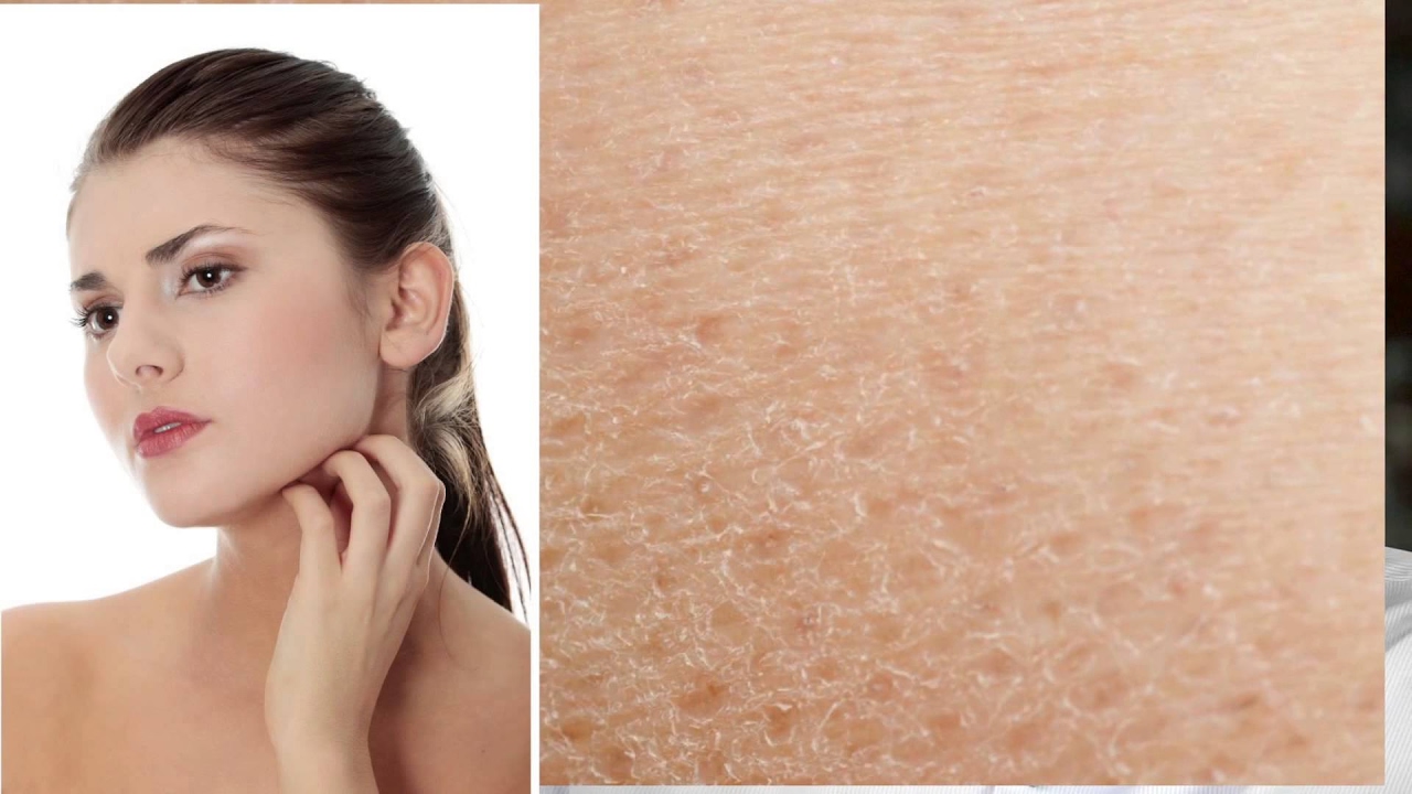 هۆکارو چارەسەری وشکی پێست چییە؟