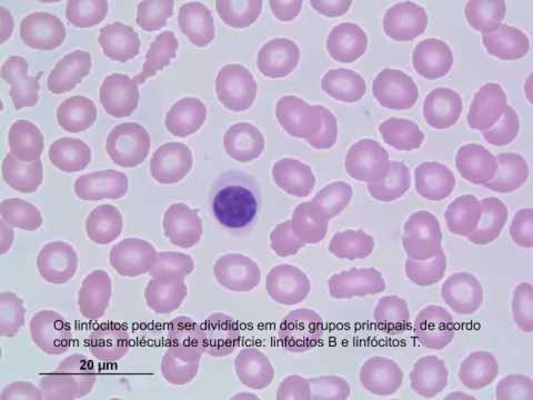 Vídeo: Diferença Entre Células Polimorfonucleares E Mononucleares