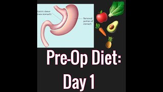 What I'm eating: 2 week PRE-OP diet for Vertical Sleeve Gastrectomy (VSG OR GASTRIC SLEEVE) surgery.