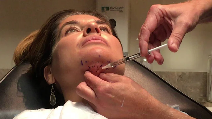Kybella Injection Demonstration - Beverly Hills Ph...