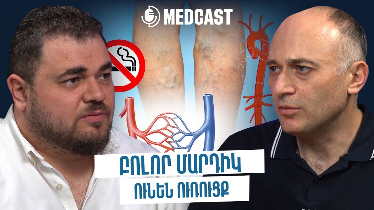 Վարիկոզ, թրոմբի հեռացման միջոցներ, դիաբետով կյանք և առողջ ապրելակերպ | Արամ Խաչատրյան | MedCast 107