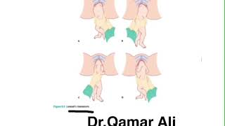 Loveset Maneuver For Delivery Of Breech Presentations Child