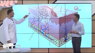 Доктор знает! Вирус папилломы человека (ВПЧ) | Телеканал 