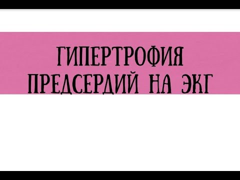 Расшифровка ЭКГ при гипертрофии предсердий — meduniver.com