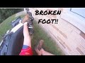 DIRT BIKE CRASH! - BROKEN FOOT!!