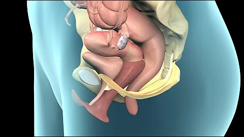 Pelvic Prolapse | Nucleus Health - DayDayNews