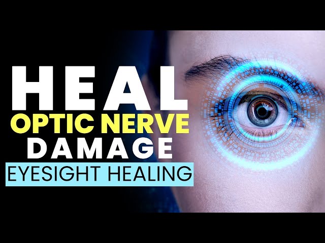 Eyesight Healing Frequency | Heal Optic Nerve Damage | Get Relief from Eye Strain Fast | 528Hz Music class=