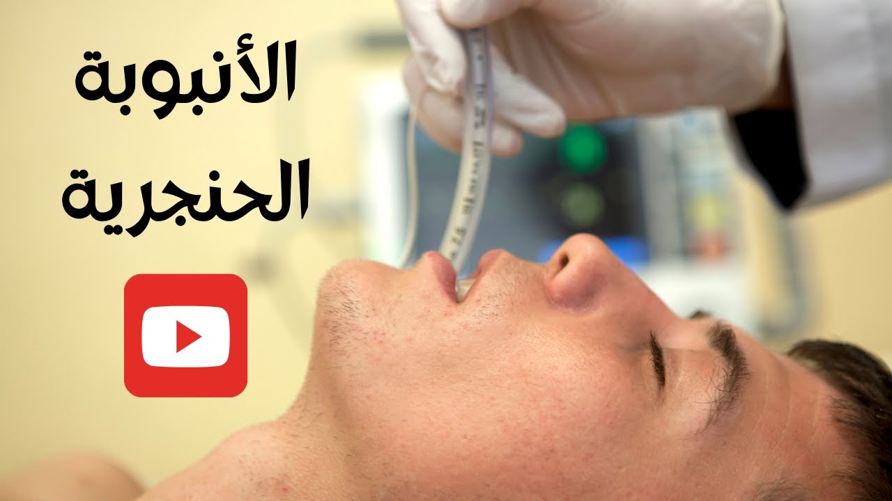 الأنبوبة الحنجرية  و جهاز التنفس الصناعي