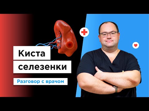 Что нужно знать о кисте селезенки? Рассказывает врач