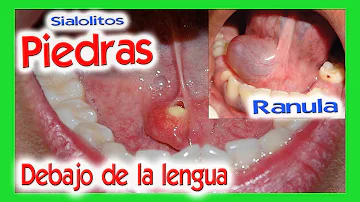 ¿Cómo se llama lo que tienes debajo de la lengua?