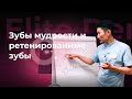 Зубы мудрости какие они бывают и когда нужно их удалять?