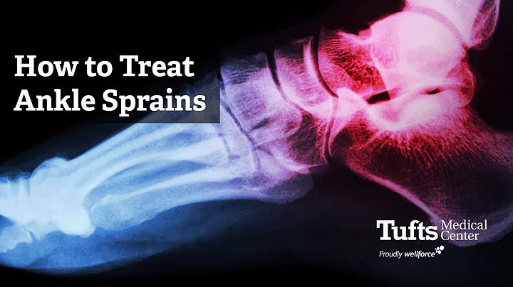 How to Treat Ankle Sprains with Dr. Matt Salzler | Tufts Medical Center