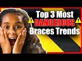 Top 3 most dangerous braces trends  tik tok braces trends