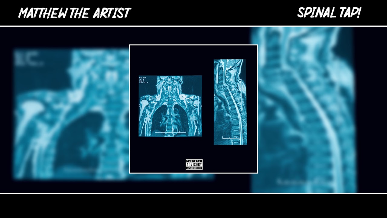 Watch Matthew The Artist - Spinal Tap! (Official Audio) on YouTube Watch Matthew The Artist - Spinal Tap! (Official Audio) on YouTube