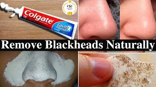 In Just 2 Mints Best Way to Remove BLACKHEADS  Naturally|| How to Remove Blackheads With Toothpaste screenshot 1