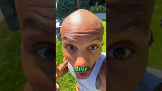 I Became Solluminati Instantly After Going Bald