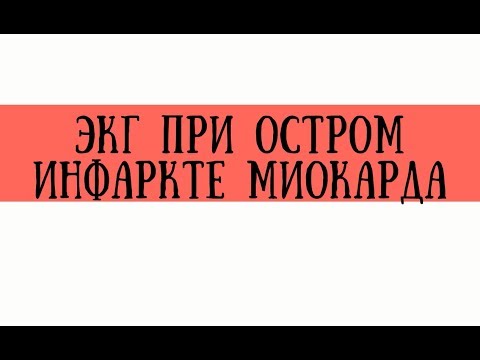 Video: Lékařská Péče O Pacienty S Akutním Infarktem Myokardu V Zemi Omezující Zdroje, Trinidad: Průřezová Retrospektivní Studie