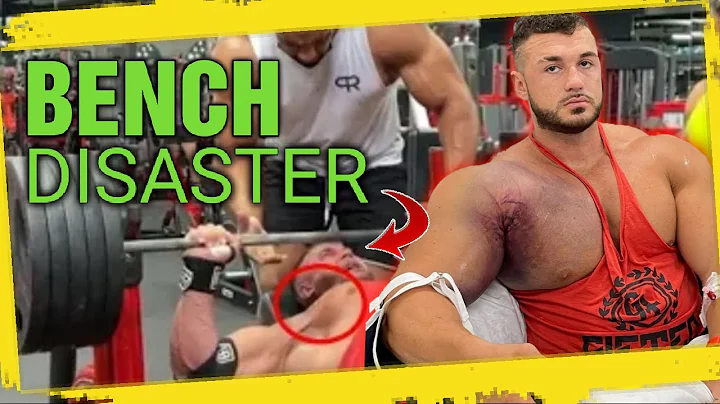 Ryan Crowley || Bench Disaster & Pec Tear Surgery