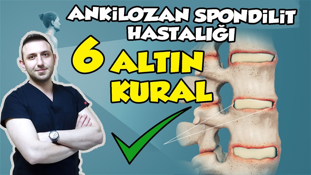 Ankilozan Spondilit (AS) Tedavisi: Ağrıyı Azaltan 6 ALTIN KURAL ve Yaşam Tarzı Rehberi