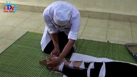 Kỹ thuật Cố định gãy kín xương cẳng chân