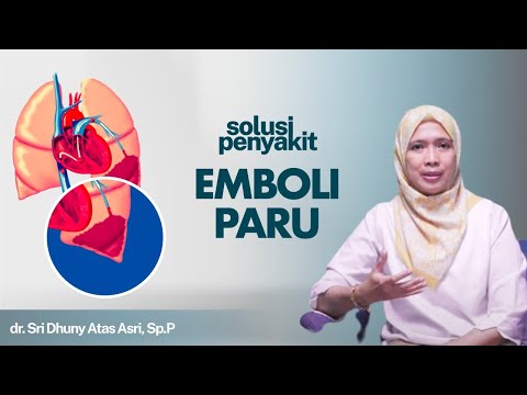 Video: 3 Cara Mencegah Emboli Paru