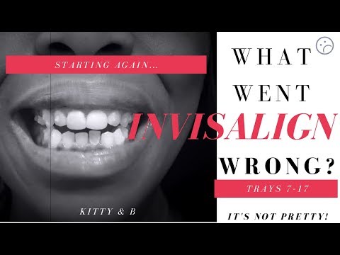 Invisalign what went wrong!| Starting over| IPR | Rescan |Attachments| Progress Trays 7-17 Kitty & B