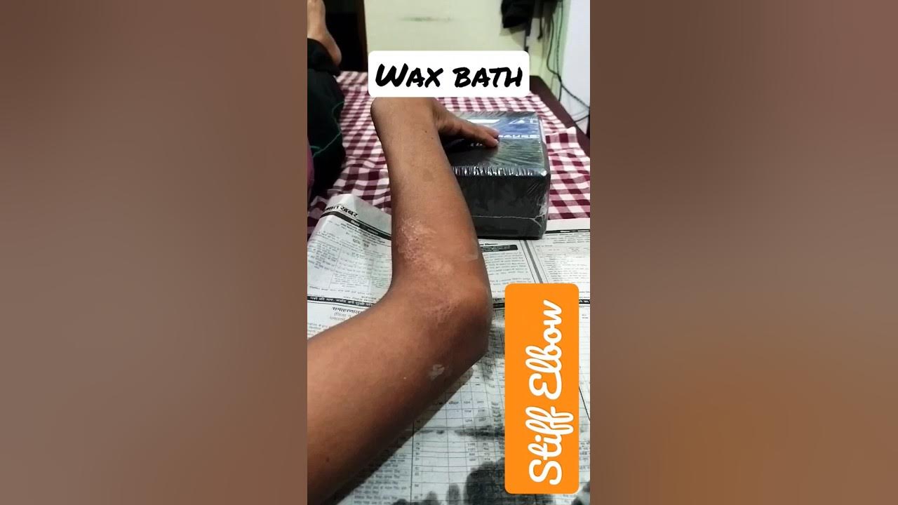 Wax Bath therapy for stiffness in elbow joint shorts physiotherapy 