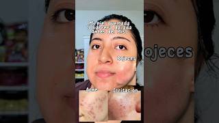 Este mist es una joyita 😮💨 #skincarecoreano #kbeauty #kbeautyskincare #transformation #acne #fyp