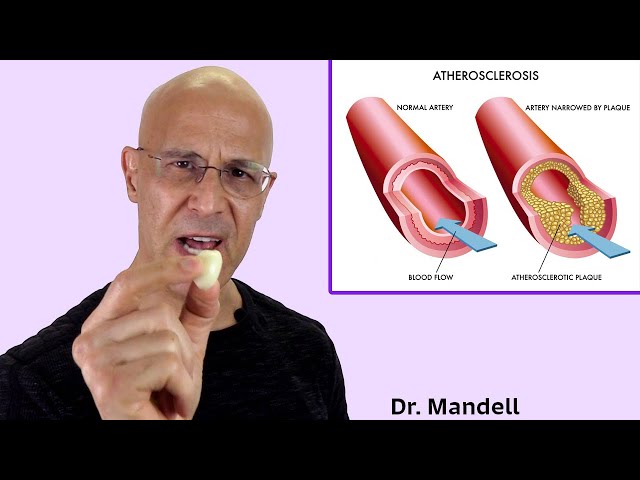 1 Crushed Garlic Clove a Day...Your Heart & Arteries Will Thank You in Many Ways | Dr Mandell class=