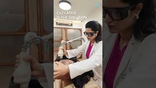 Say goodbye to dark underarms with our advanced CO2 laser treatment at Kopikar Dermatology!